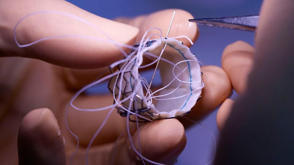 Edwards Lifesciences lockt mit Innovationen